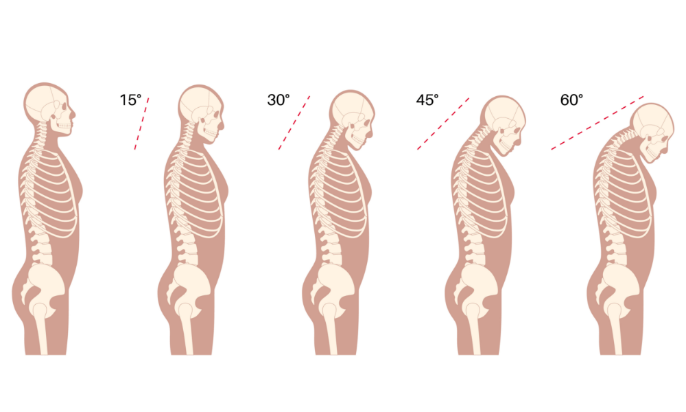頭と首の位置関係